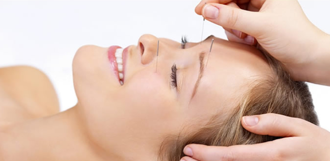 COSMETIC ACUPUNCTURE
